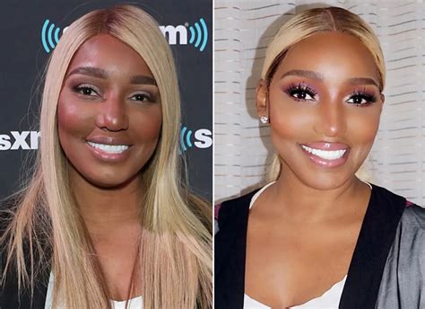 Complete Details of Every NeNe Leakes Plastic Surgery